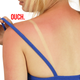 Illustration for article titled Get Rid of Embarrassing Sunburn